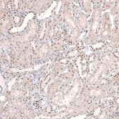 Anti-MED20 antibody produced in rabbit Prestige Antibodies&#174; Powered by Atlas Antibodies, affinity isolated antibody, buffered aqueous glycerol solution