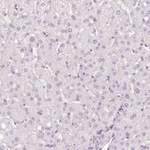 Anti-ZNF610 antibody produced in rabbit Prestige Antibodies&#174; Powered by Atlas Antibodies, affinity isolated antibody, buffered aqueous glycerol solution