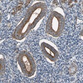 Anti-VPS41 antibody produced in rabbit Prestige Antibodies&#174; Powered by Atlas Antibodies, affinity isolated antibody, buffered aqueous glycerol solution, Ab2