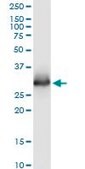 Monoclonal Anti-ELA3A antibody produced in mouse clone 3G4, purified immunoglobulin, buffered aqueous solution
