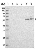 Anti-C16orf70 antibody produced in rabbit Prestige Antibodies® Powered by Atlas Antibodies, affinity isolated antibody, buffered aqueous glycerol solution