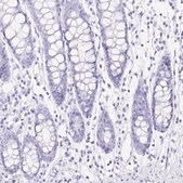 Anti-PRR4 antibody produced in rabbit Prestige Antibodies&#174; Powered by Atlas Antibodies, affinity isolated antibody, buffered aqueous glycerol solution