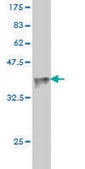 Monoclonal Anti-SPSB2 antibody produced in mouse clone 1E6, purified immunoglobulin, buffered aqueous solution