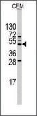 Anti-HS2ST1 (center) antibody produced in rabbit IgG fraction of antiserum, buffered aqueous solution