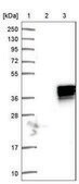 Anti-TBX20 antibody produced in rabbit Prestige Antibodies® Powered by Atlas Antibodies, affinity isolated antibody, buffered aqueous glycerol solution