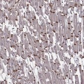 Anti-PKP2 antibody produced in rabbit Prestige Antibodies&#174; Powered by Atlas Antibodies, affinity isolated antibody