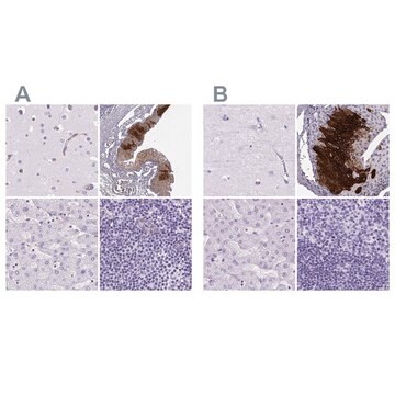 Anti-KRT12 antibody produced in rabbit Prestige Antibodies&#174; Powered by Atlas Antibodies, affinity isolated antibody