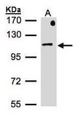 Anti-AP1B1 antibody produced in rabbit affinity isolated antibody, buffered aqueous solution