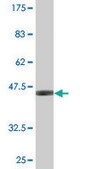 Monoclonal Anti-SNCB antibody produced in mouse clone 3H4, purified immunoglobulin, buffered aqueous solution