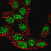 Anti-GXYLT2 antibody produced in rabbit Prestige Antibodies&#174; Powered by Atlas Antibodies, affinity isolated antibody, buffered aqueous glycerol solution