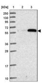 Anti-ZSCAN5A antibody produced in rabbit Prestige Antibodies&#174; Powered by Atlas Antibodies, affinity isolated antibody, buffered aqueous glycerol solution