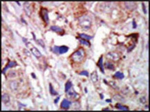 Anti-ZPK (C-term) antibody produced in rabbit IgG fraction of antiserum, buffered aqueous solution