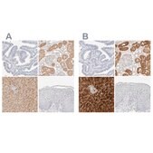 Anti-RIDA antibody produced in rabbit Prestige Antibodies® Powered by Atlas Antibodies, affinity isolated antibody, buffered aqueous glycerol solution, Ab2