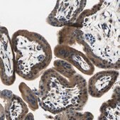 Anti-DDX3X antibody produced in rabbit Prestige Antibodies&#174; Powered by Atlas Antibodies, affinity isolated antibody, buffered aqueous glycerol solution