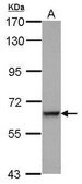 Anti-C9 antibody produced in rabbit affinity isolated antibody, buffered aqueous solution