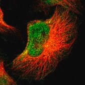 Anti-FOXN2 antibody produced in rabbit Prestige Antibodies&#174; Powered by Atlas Antibodies, affinity isolated antibody, buffered aqueous glycerol solution