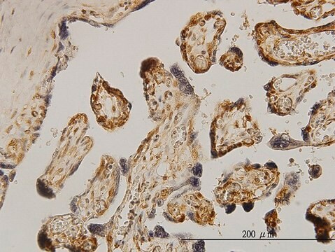Monoclonal Anti-RPS6KB1 antibody produced in mouse clone 1E12, purified immunoglobulin, buffered aqueous solution
