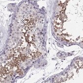 Anti-DNAAF1 Prestige Antibodies® Powered by Atlas Antibodies, affinity isolated antibody