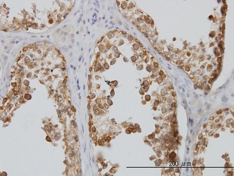 Monoclonal Anti-DDX6 antibody produced in mouse clone 3D2, purified immunoglobulin, buffered aqueous solution