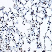 Anti- Twist antibody produced in rabbit