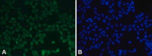 Anti-NBS1 (Nibrin), C-terminal antibody produced in rabbit affinity isolated antibody, buffered aqueous solution