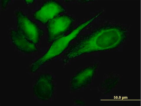 Monoclonal Anti-TBC1D8 antibody produced in mouse clone 1A12, purified immunoglobulin, buffered aqueous solution