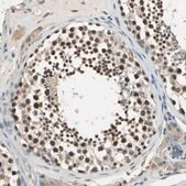 Anti-FAM208A antibody produced in rabbit Prestige Antibodies® Powered by Atlas Antibodies, affinity isolated antibody, buffered aqueous glycerol solution