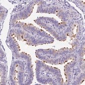 Anti-DLEC1 antibody produced in rabbit Prestige Antibodies&#174; Powered by Atlas Antibodies, affinity isolated antibody, buffered aqueous glycerol solution