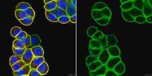 Anti-Epithelial Cell Adhesion Molecule (EpCAM) Antibody, clone 8 clone mab 8, from mouse