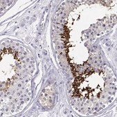 Anti-CABS1 antibody produced in rabbit Prestige Antibodies&#174; Powered by Atlas Antibodies, affinity isolated antibody, buffered aqueous glycerol solution