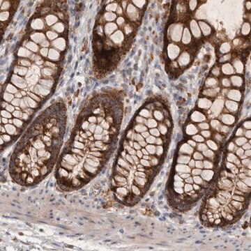 Anti-MRPL41 antibody produced in rabbit Prestige Antibodies&#174; Powered by Atlas Antibodies, affinity isolated antibody, buffered aqueous glycerol solution, Ab2