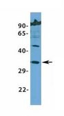 Anti-HOXB2 antibody produced in rabbit affinity isolated antibody