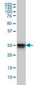 单克隆抗-HMGB1 小鼠抗 clone 2F6, purified immunoglobulin, buffered aqueous solution