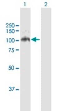 Anti-LDLR antibody produced in mouse purified immunoglobulin, buffered aqueous solution