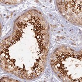 Anti-WDR62 antibody produced in rabbit Prestige Antibodies&#174; Powered by Atlas Antibodies, affinity isolated antibody, buffered aqueous glycerol solution