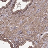 抗-PPP1R12A 兔抗 Prestige Antibodies&#174; Powered by Atlas Antibodies, affinity isolated antibody