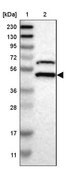Anti-SSB antibody produced in rabbit Prestige Antibodies&#174; Powered by Atlas Antibodies, affinity isolated antibody, buffered aqueous glycerol solution