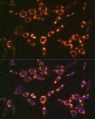 Anti-PBR/TSPO antibody produced in rabbit