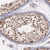 Anti-SIPA1L1 antibody produced in rabbit Prestige Antibodies&#174; Powered by Atlas Antibodies, affinity isolated antibody, buffered aqueous glycerol solution