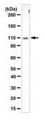 Anti-Dihydropyrimidine dehydrogenase/DPYD Antibody from rabbit, purified by affinity chromatography