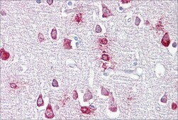 Anti-PPME1, (N-terminal) antibody produced in rabbit affinity isolated antibody