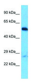 Anti-OTUD1 (C-terminal) antibody produced in rabbit affinity isolated antibody