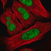 Anti-FOXR2 antibody produced in rabbit Prestige Antibodies&#174; Powered by Atlas Antibodies, affinity isolated antibody