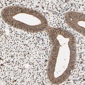Anti-PNCK antibody produced in rabbit Prestige Antibodies&#174; Powered by Atlas Antibodies, affinity isolated antibody, buffered aqueous glycerol solution