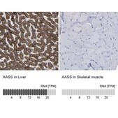 Anti-AASS antibody produced in rabbit Prestige Antibodies® Powered by Atlas Antibodies, affinity isolated antibody, buffered aqueous glycerol solution, Ab1