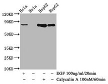 Anti-phospho-GYS1 (S641) antibody, clone 1D1, Rabbit Monoclonal recombinant, expressed in HEK293F cells
