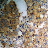 Anti-phospho-PKC δ (pThr505) antibody produced in rabbit affinity isolated antibody