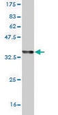 Monoclonal Anti-ZW10 antibody produced in mouse clone 2E5, purified immunoglobulin, buffered aqueous solution