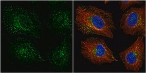 Anti-VPS35 (C-terminal) antibody produced in rabbit affinity isolated antibody, buffered aqueous solution
