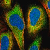 Anti-DHX36 antibody produced in rabbit Prestige Antibodies&#174; Powered by Atlas Antibodies, affinity isolated antibody, buffered aqueous glycerol solution
